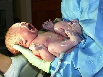 Медики Адыгеи выясняют причину повышения уровня младенческой смертности